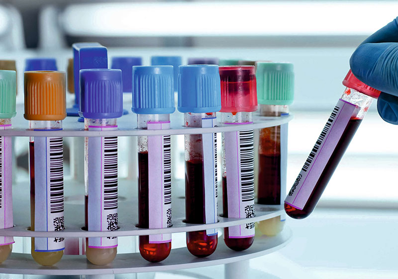 several blood samples in a lab
